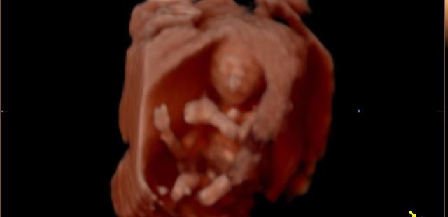 14188631_10207741413918964_5677884629258604888_o